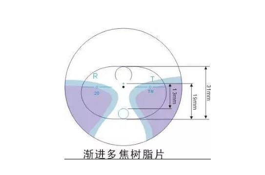 美麗島漸進(jìn)多焦鏡適合的人群，需要注意的事項(xiàng)